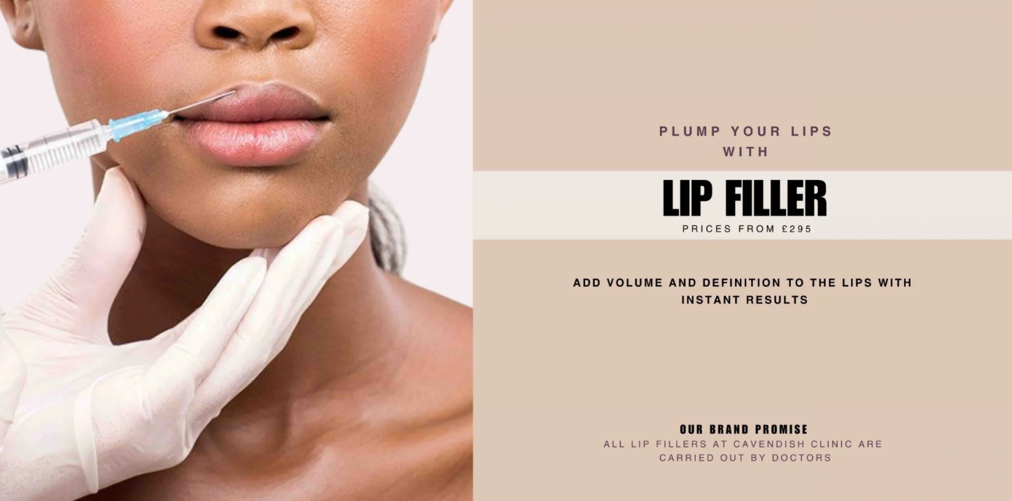 filler lips